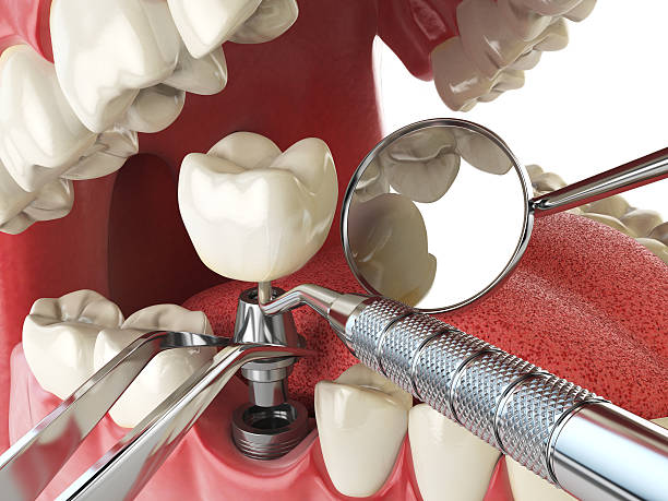 Best Emergency Treatment for Jaw Pain or Injury in Slater Marietta, SC
