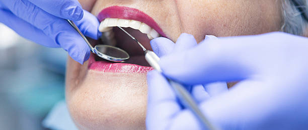 Best Knocked-Out Tooth (Avulsed Tooth) Treatment in Slater Marietta, SC